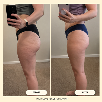 NØRD BODY Anti-Cellulite Massage Oil